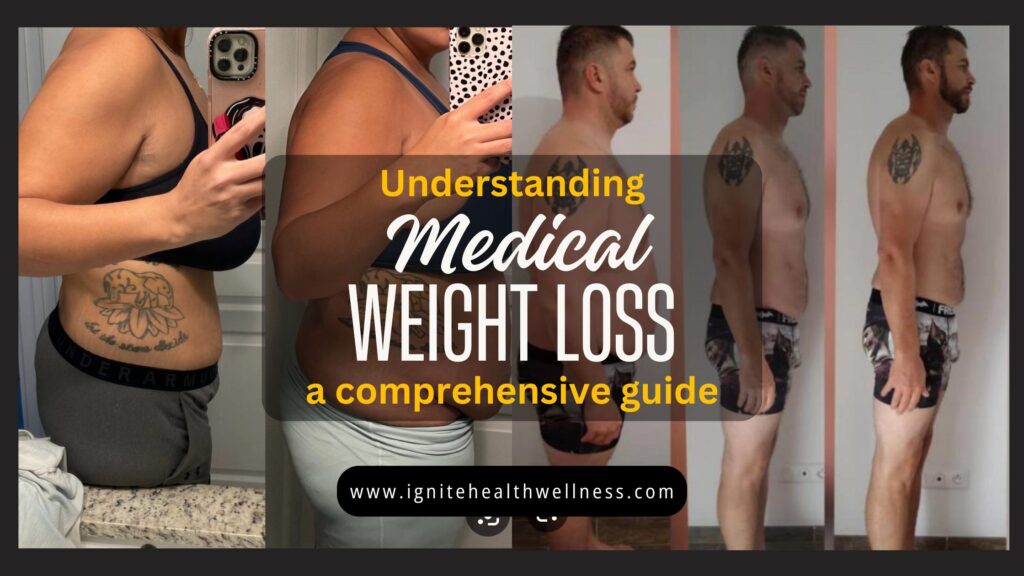 Understanding Medical Weight Loss – A Comprehensive Guide